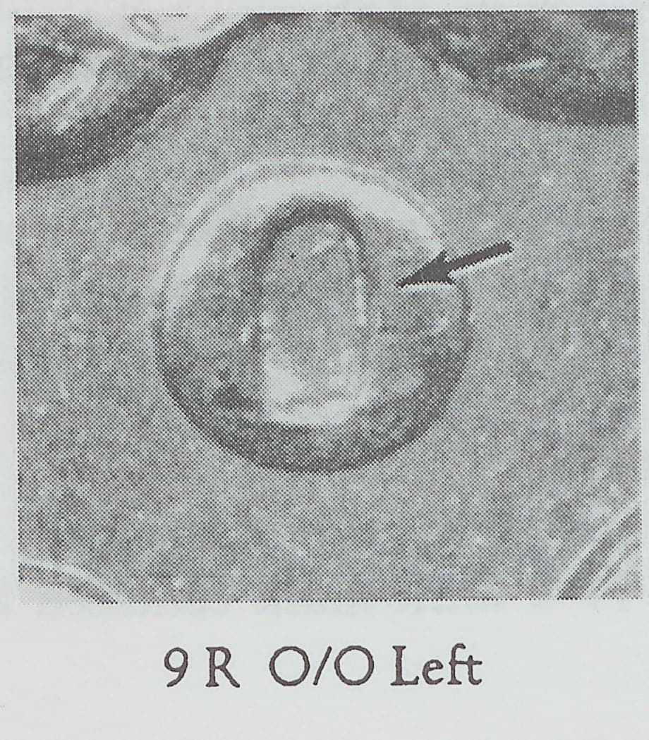 1892-O VAM-9