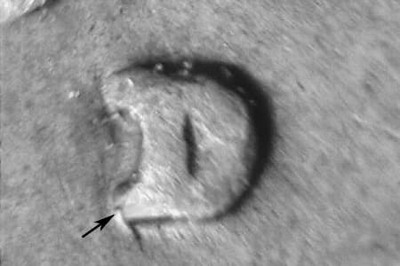 1915-D Repunched Mintmark WRPM-002