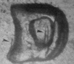 1959-D Repunched Mintmark RPM-004